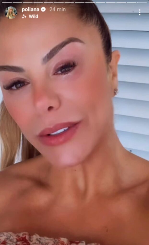 Poliana Rocha, mulher de Leonardo, mostra olho inchado e vermelhidão
