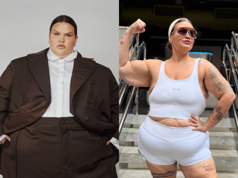 Antes e depois de Thais Carla depois de cirurgia bariátrica