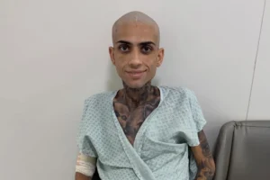 Jota Surfista sorrindo, sentado em uma cadeira de hospital. Ele está careca, usando um roupão de paciente verde com padrões geométricos e tem os braços enfaixados. Tatuagens são visíveis em seu pescoço e braço. O fundo é uma parede branca simples.