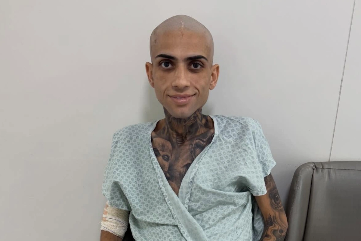 Jota Surfista sorrindo, sentado em uma cadeira de hospital. Ele está careca, usando um roupão de paciente verde com padrões geométricos e tem os braços enfaixados. Tatuagens são visíveis em seu pescoço e braço. O fundo é uma parede branca simples.