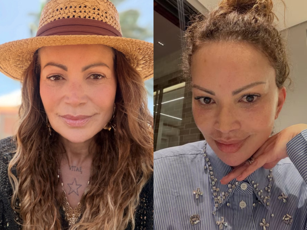 Antes e depois da cantora Solange Almeida