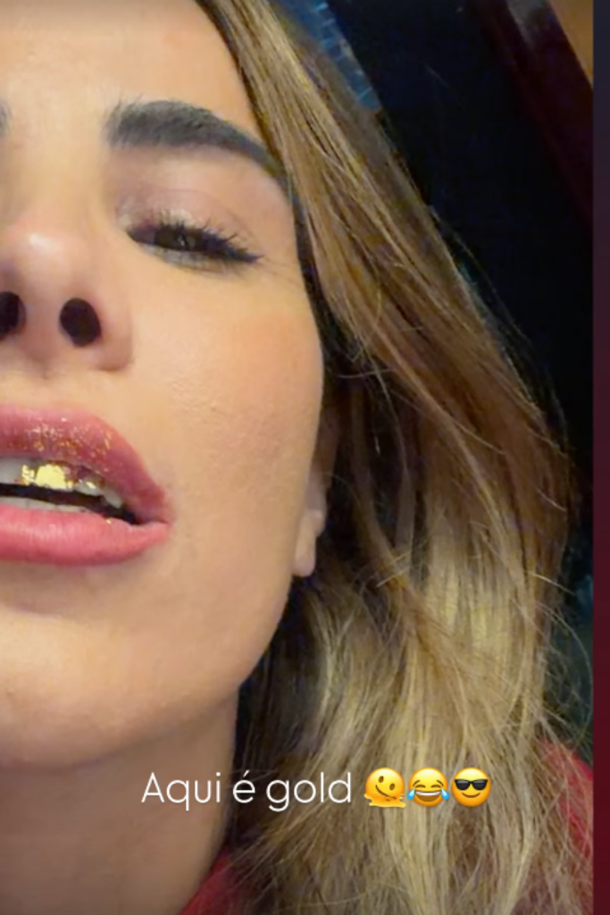 Close do rosto de Wanessa Camargo mostrando detalhe dourado nos dentes. Na legenda da foto, o texto "Aqui é gold" com emojis.