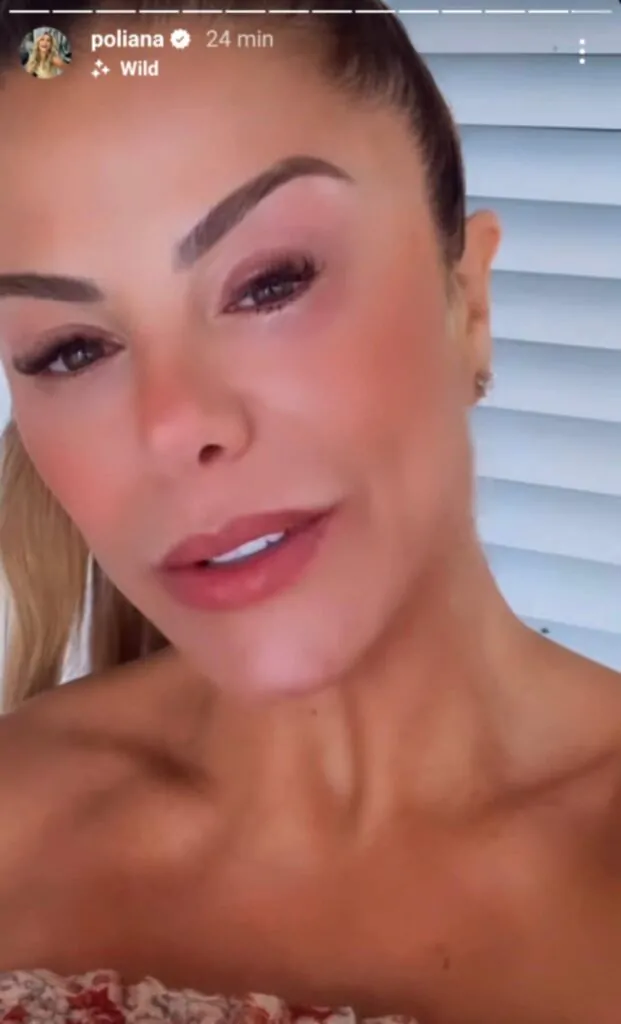 Poliana Rocha, mulher de Leonardo, mostra olho inchado e vermelhidão