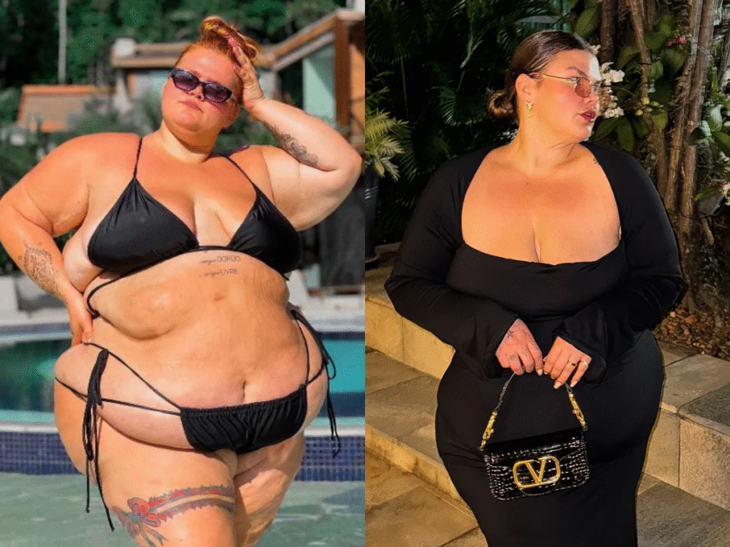 Antes e depois de Thais Carla, que fez bariátrica