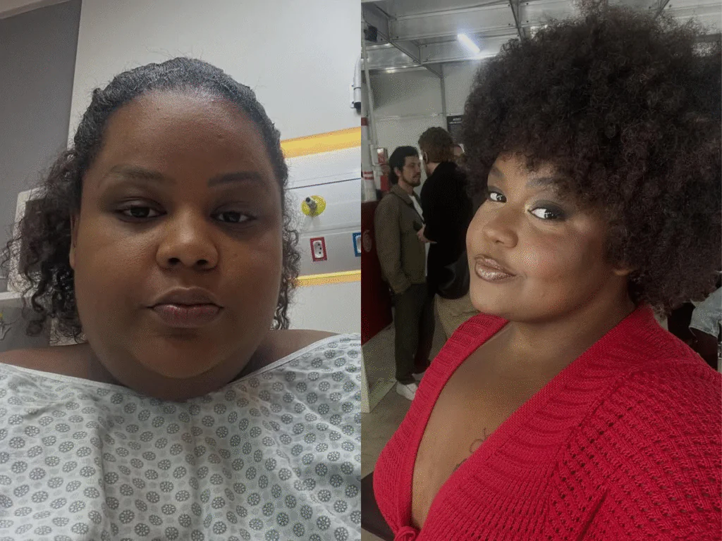 Cantora MC Carol passa por lipo de papada