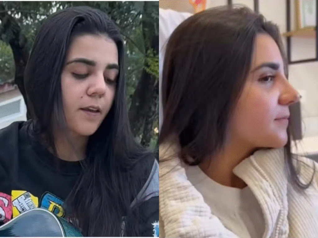 Yasmin Santos mostra seu novo nariz após rinoplastia