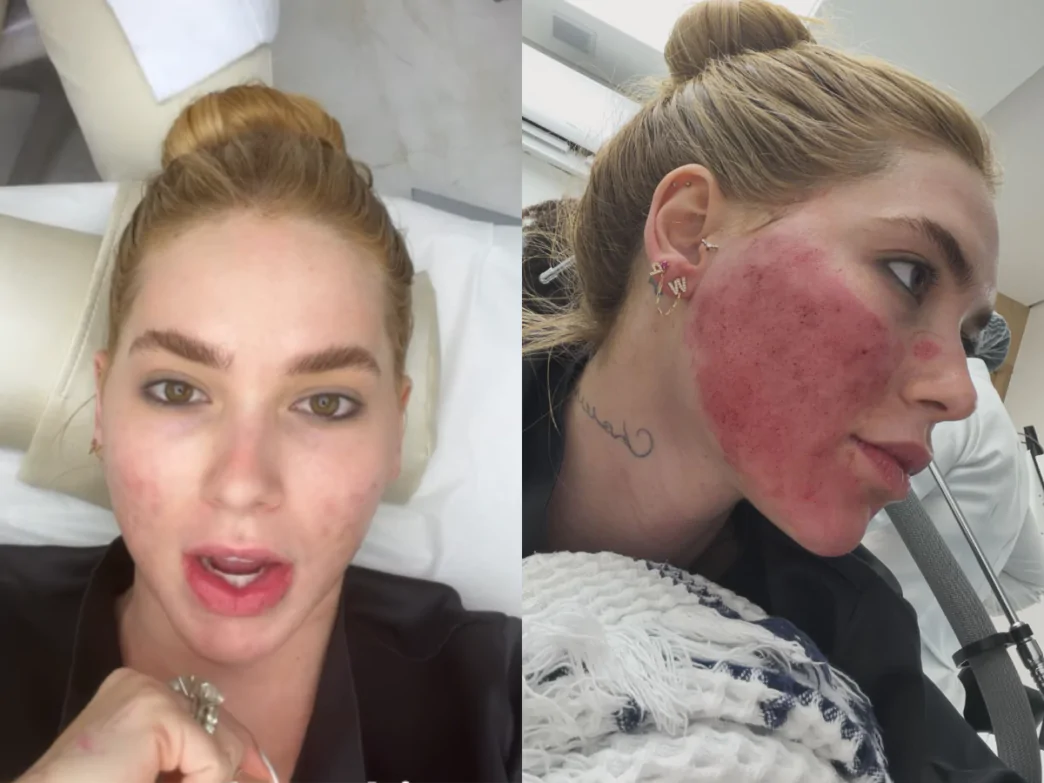 Influenciadora Virginia Fonseca