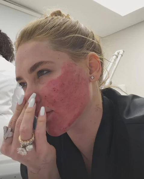 Virginia Fonseca mostra o rosto após procedimento