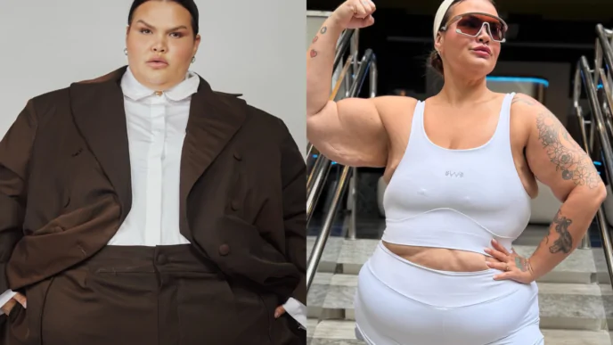 Antes e depois de Thais Carla depois de cirurgia bariátrica