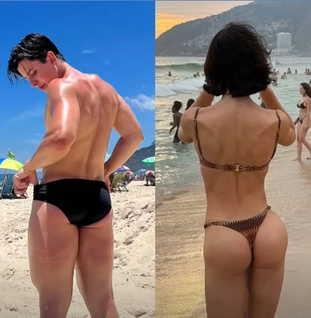 Fotos da influenciadora trans Bella Longuinho após procedimento no bumbum